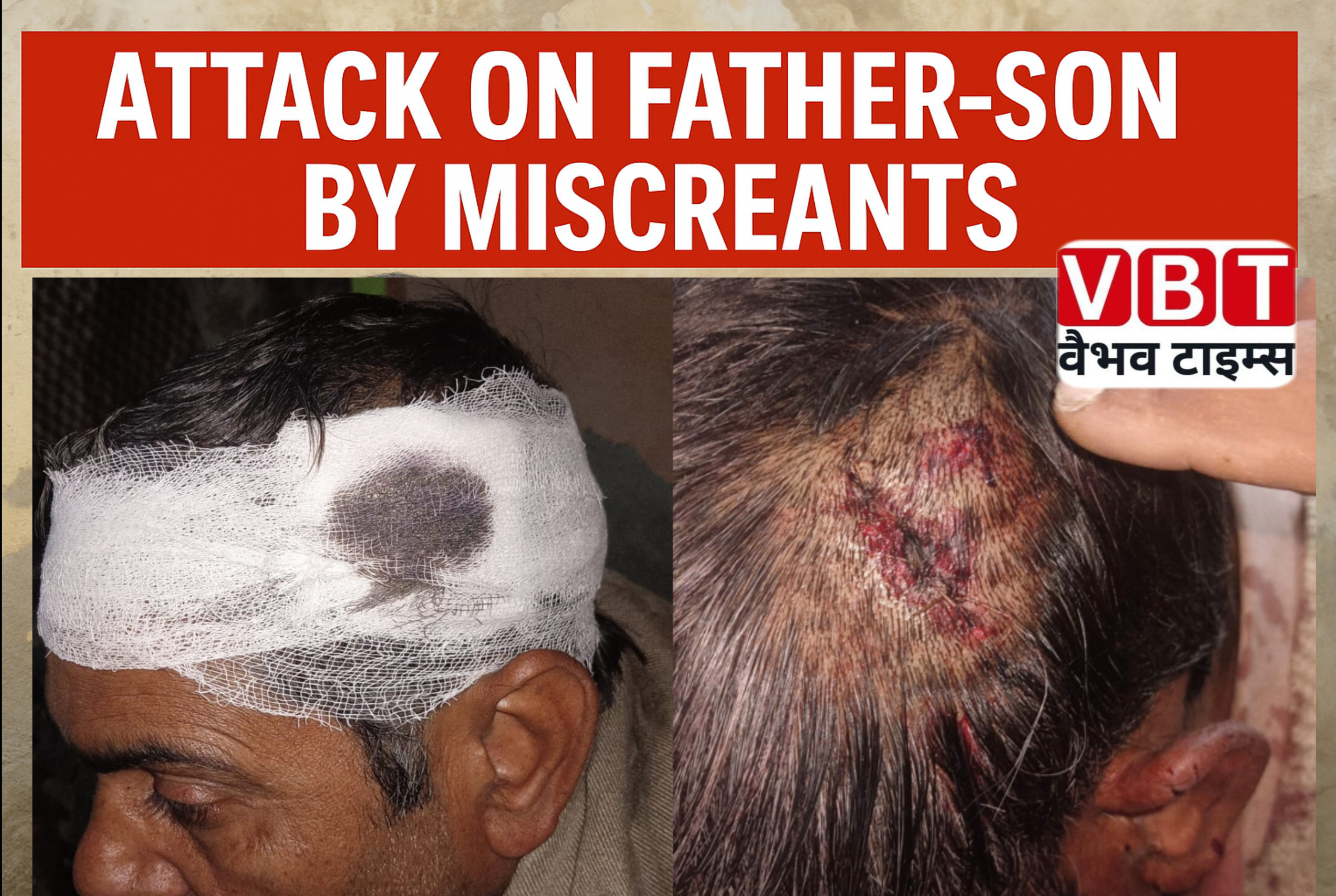 टप्पल: दबंगों ने बाप–बेटे पर किया हमला, 4 दिन बाद भी आरोपी फरार